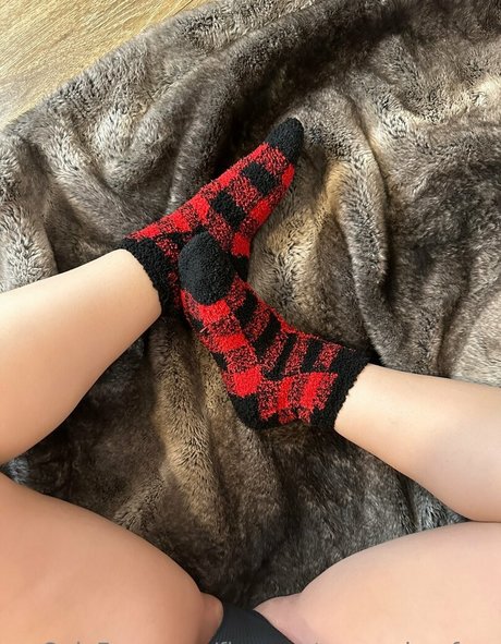 Fingers_toes_soles_free