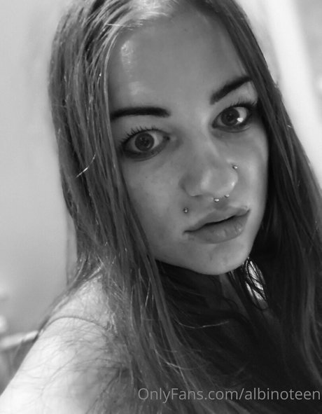 Nagie wyciekłe zdjęcie OnlyFans od Albinoteen