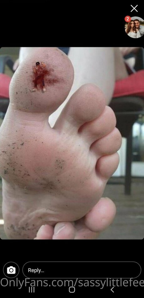 Nagie wyciekłe zdjęcie OnlyFans od Sassylittlefeet